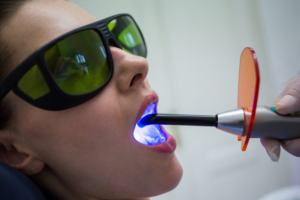 dentist examining patients teeth with dental curing light